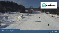 Archived image Webcam Malá Morávka - Kopřivná 10:00