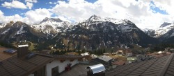 Archived image Webcam Hotel Goldener Berg: village view Oberlech 11:00