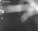 Archiv Foto Webcam Körbecke: Blick auf die Seetreppe am Möhnesee 23:00