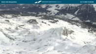 Archiv Foto Webcam Kleinwalsertal: Ifenbergbahn Hahnenköpfle 10:00