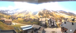 Archived image Webcam Malbun Triesenberg - Hotel Turna 13:00
