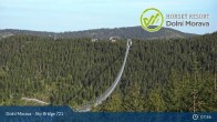 Archived image Webcam Dolni Morava - Slopes at U Slona Chairlift 07:00