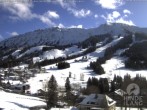 Archiv Foto Webcam Kinderhotel Oberjoch 11:00