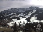 Archived image Webcam Kids hotel Oberjoch 11:00