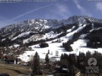 Archived image Webcam Kids hotel Oberjoch 13:00