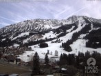 Archiv Foto Webcam Kinderhotel Oberjoch 15:00