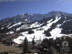 Archiv Foto Webcam Kinderhotel Oberjoch 11:00