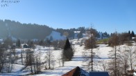 Archiv Foto Webcam Oberstaufen: Biohotel Schratt - Blick zur Imbergbahn 13:00