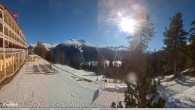 Archived image Webcam Schatzalp Hotel 11:00