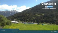 Archiv Foto Webcam Gastein: Skizentrum Angertal 10:00