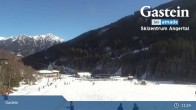 Archiv Foto Webcam Gastein: Skizentrum Angertal 10:00