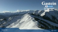 Archived image Webcam Dorgastein Ski Resort: Fulseck 06:00