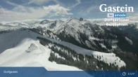 Archived image Webcam Dorgastein Ski Resort: Fulseck 12:00
